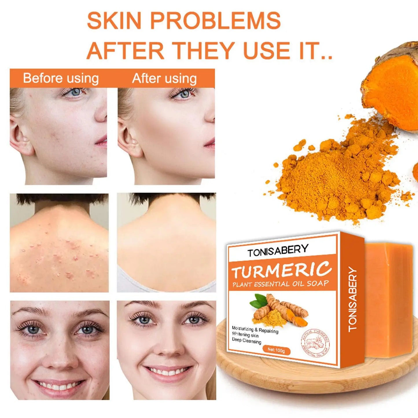 Turmeric Soap Face Cleansing Anti Acne Skin Brighten Remove Pimples Dark Spot Lightening Handmade Ginger Essential Oil Body Bath