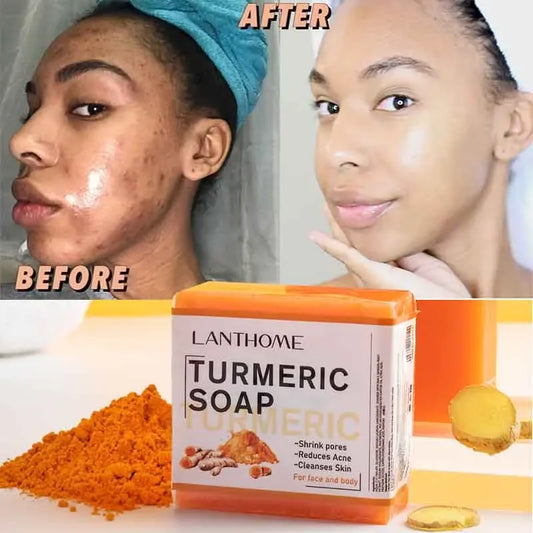 Turmeric Soap Face Cleansing Anti Acne Whitening Skin Lightening Face Remove Pimples Dark Spots Lightening Ginger Handmade Soap