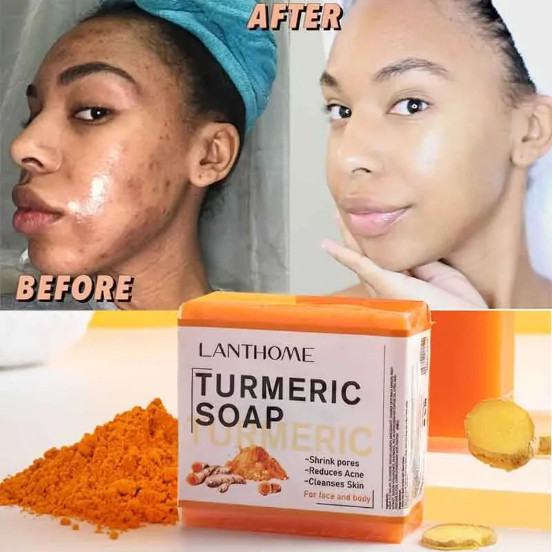 Turmeric Soap Face Cleansing Anti Acne Whitening Skin Lightening Face Remove Pimples Dark Spots Lightening Ginger Handmade Soap