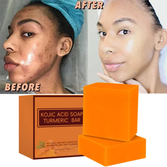 100G Kojic Acid Soap Kit Facial Cleaning Pores Dirt Acne Blackhead Anti-Acne Remove Deep Cleaning Oil Control Whitening Skin